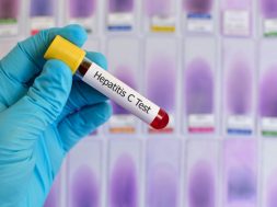 Hepatitis-C-test