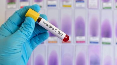 Hepatitis-C-test